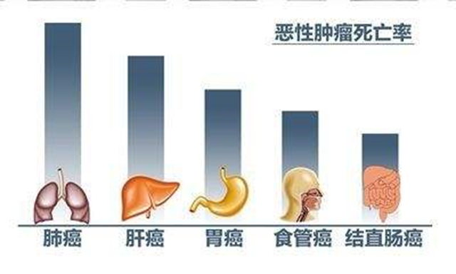 為什么健康體檢要做胸部CT？